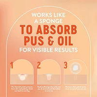 Day or Night Pimple Patches, Hydrocolloid Patches to Cover & Reduce Blemishes| Dye Free