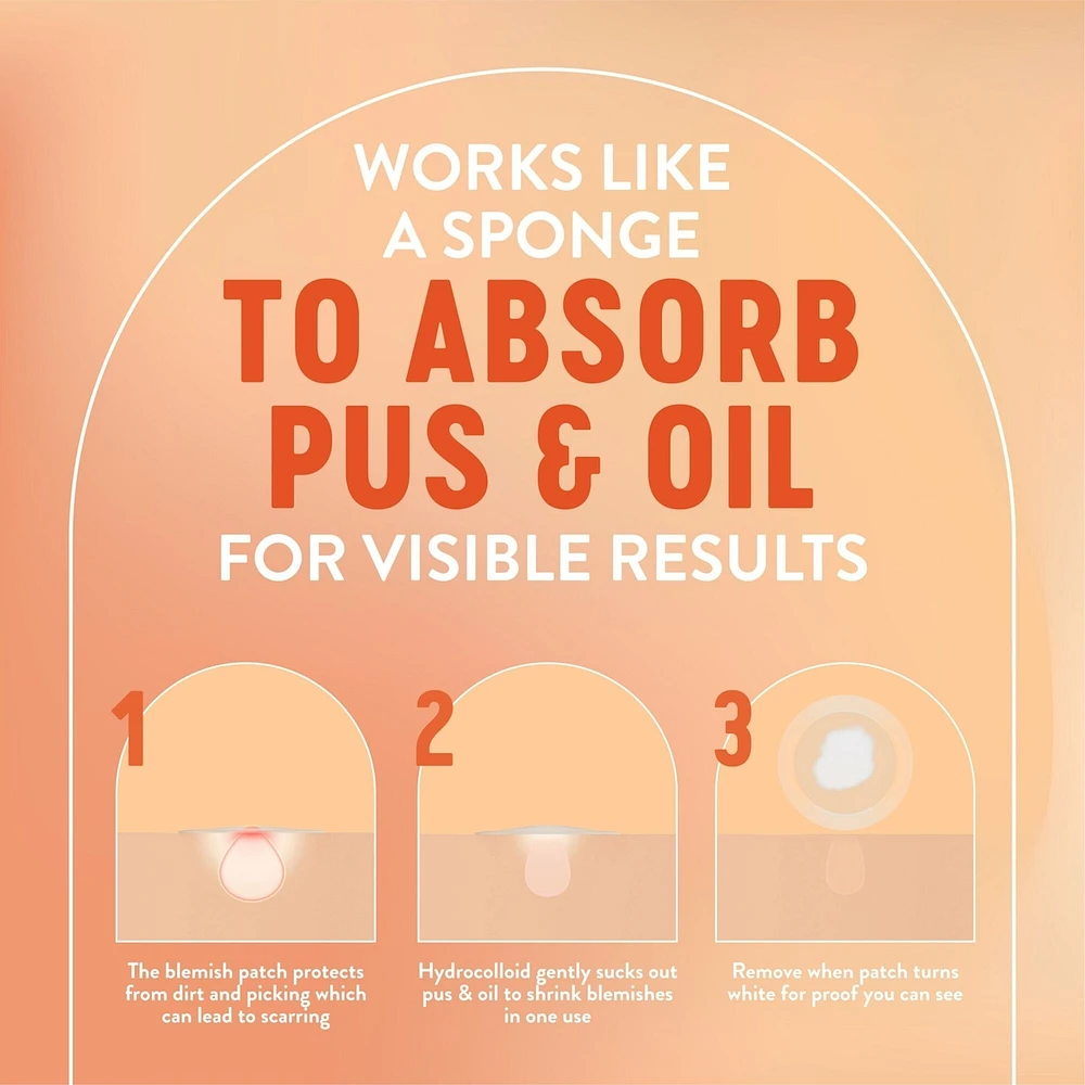 Day or Night Pimple Patches, Hydrocolloid Patches to Cover & Reduce Blemishes| Dye Free
