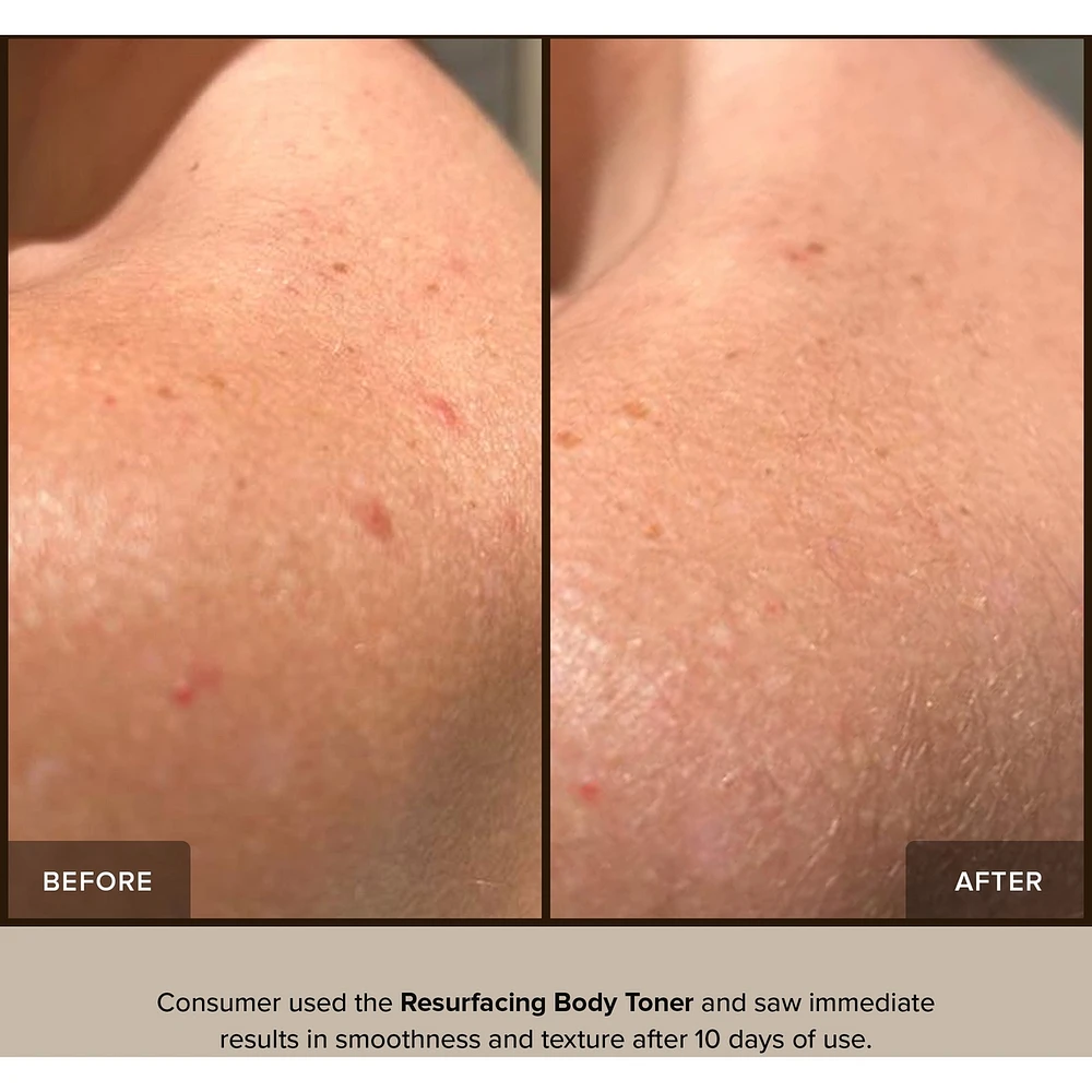Resurfacing Body Toner