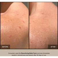 Resurfacing Body Toner