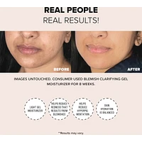 Blemish Clarifying Gel Moisturizer