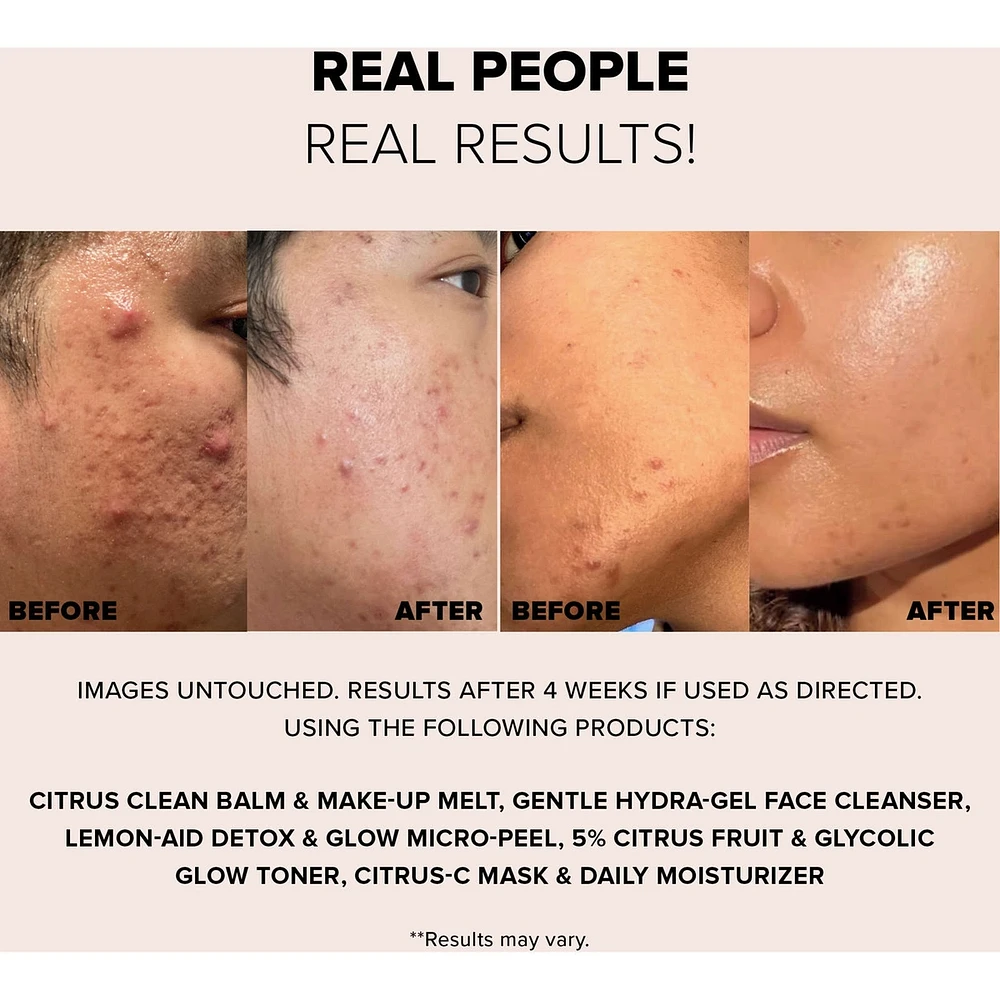 8pc Nudeskin Mini Skin Renewal Kit