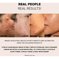 8pc Nudeskin Mini Skin Renewal Kit