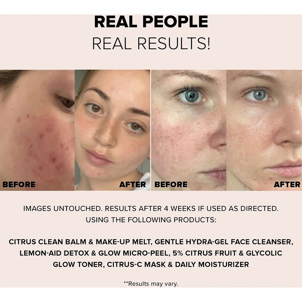 8pc Nudeskin Mini Skin Renewal Kit