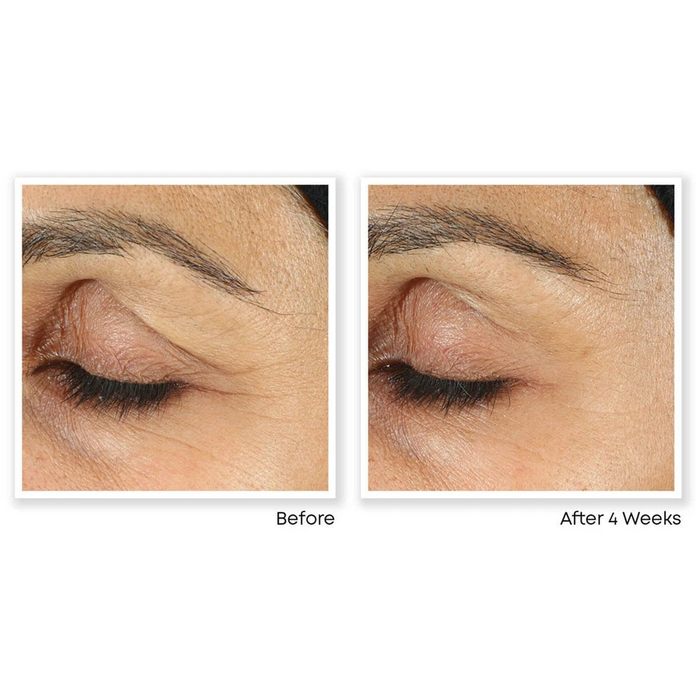 Retinol Correxion Line Smoothing Eye Cream