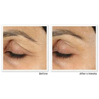 Retinol Correxion Line Smoothing Eye Cream