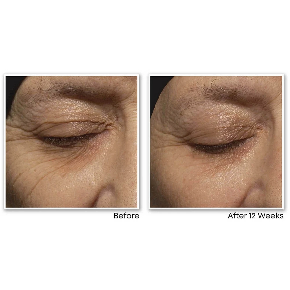 Retinol Correxion Deep Wrinkle Night Cream
