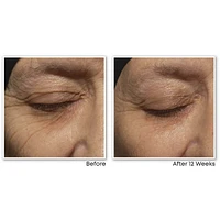 Retinol Correxion Deep Wrinkle Night Cream