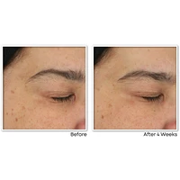 Multi Correxion Revive + Glow Gel Cream