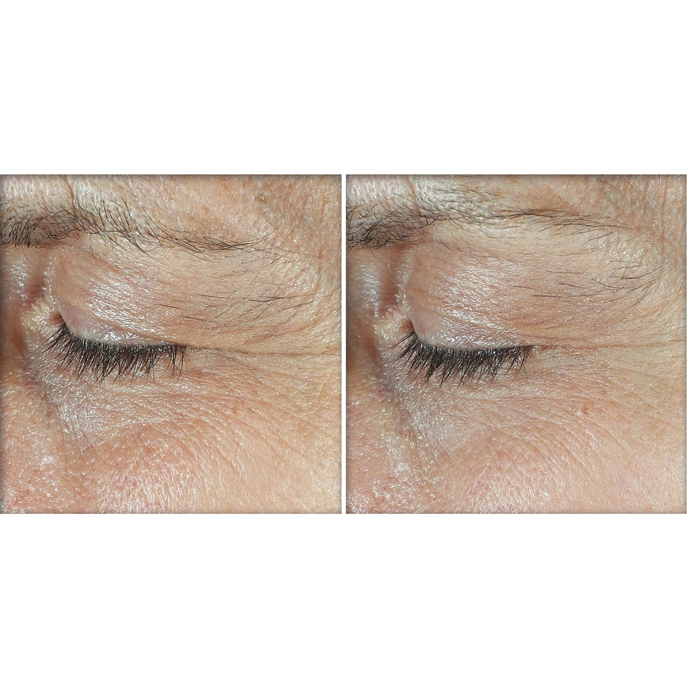 Derm Correxion®️- Dual Eye Cream - Advanced Retinol & Peptide (2x10ml)