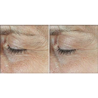 Derm Correxion®️- Dual Eye Cream - Advanced Retinol & Peptide (2x10ml)