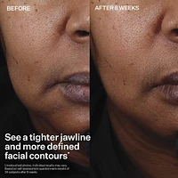 Peptight Face Lift Serum