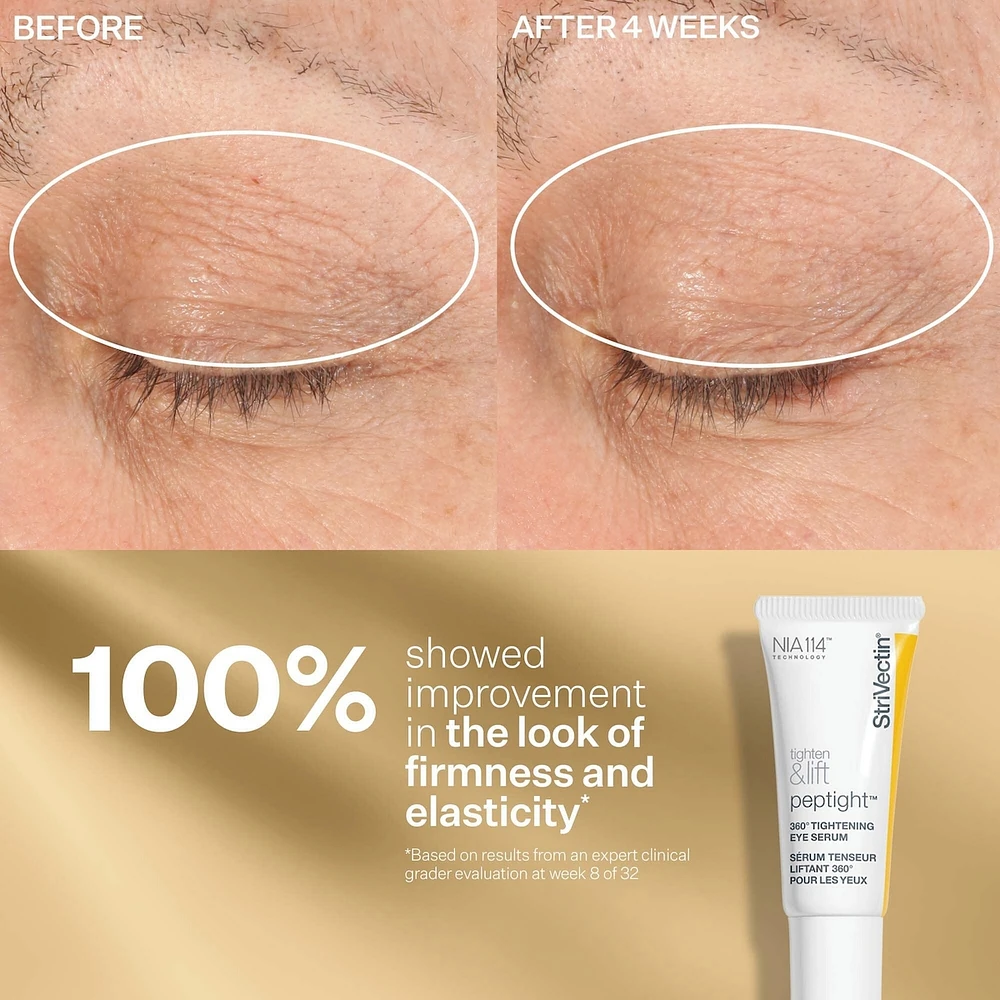 tighten & lift discovery series kit
