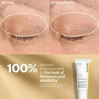 tighten & lift discovery series kit