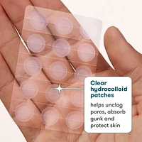 Zits Happen Clear Patches