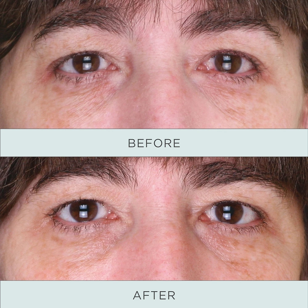 Tone Up Niacinamide firming Eye Serum