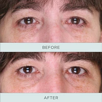Tone Up Niacinamide firming Eye Serum