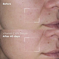 Hyaluronic Acid 1% Serum