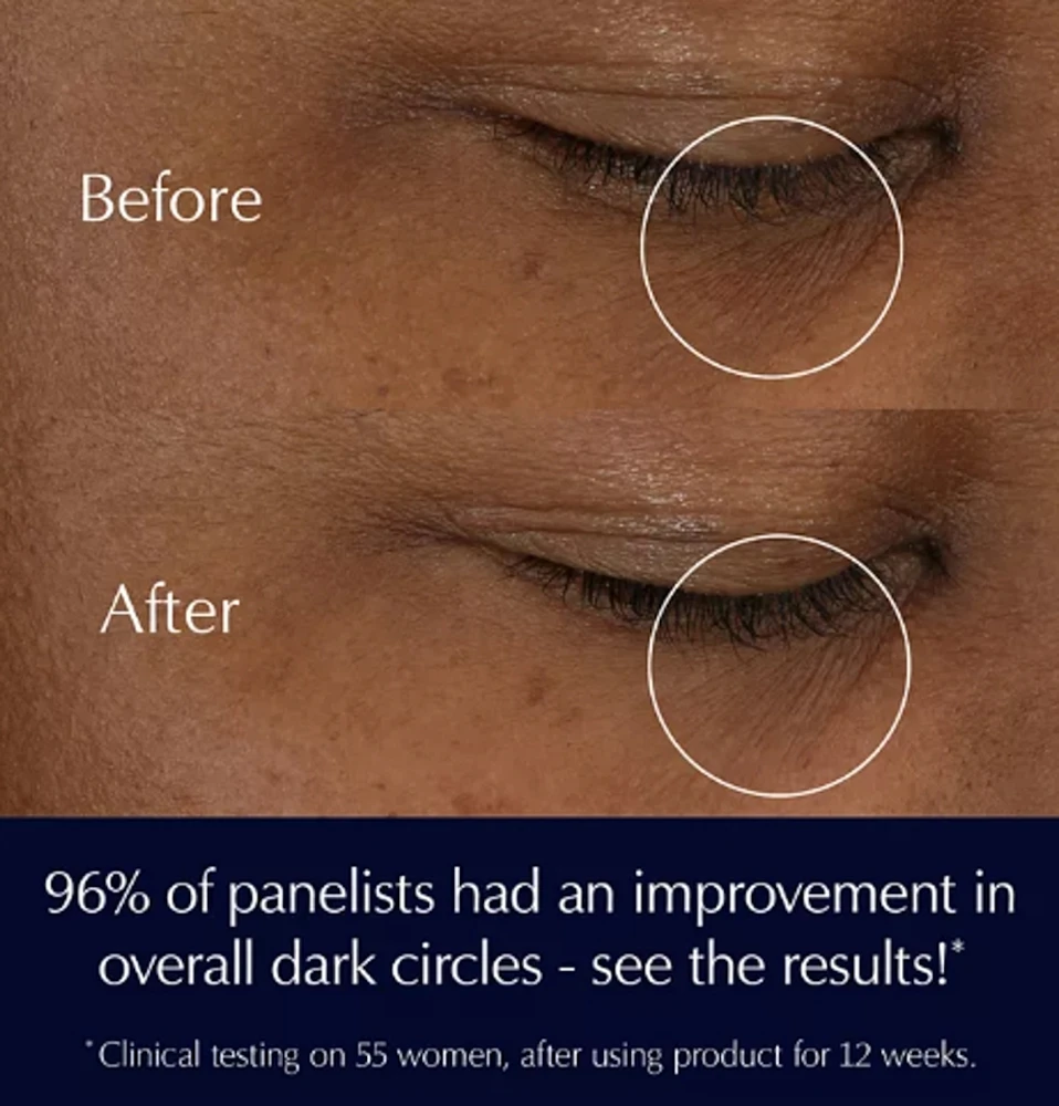 Gel-crème ultra-concentré contour des yeux Advanced Night Repair