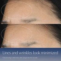 Advanced Night Repair Serum Limited Edition Bottle