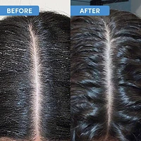Scalp Renewal