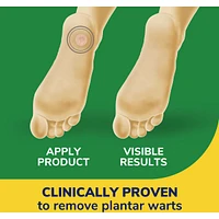 DS Clear Away Plantar Wart Remover
