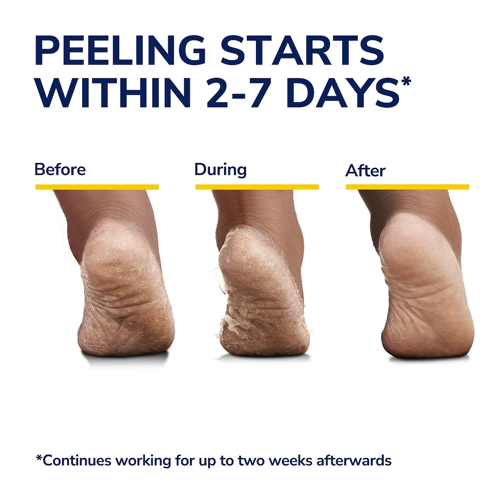 Ultra Exfoliating Foot Mask 3-pack
