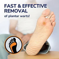 Plantar Wart Remover Gel