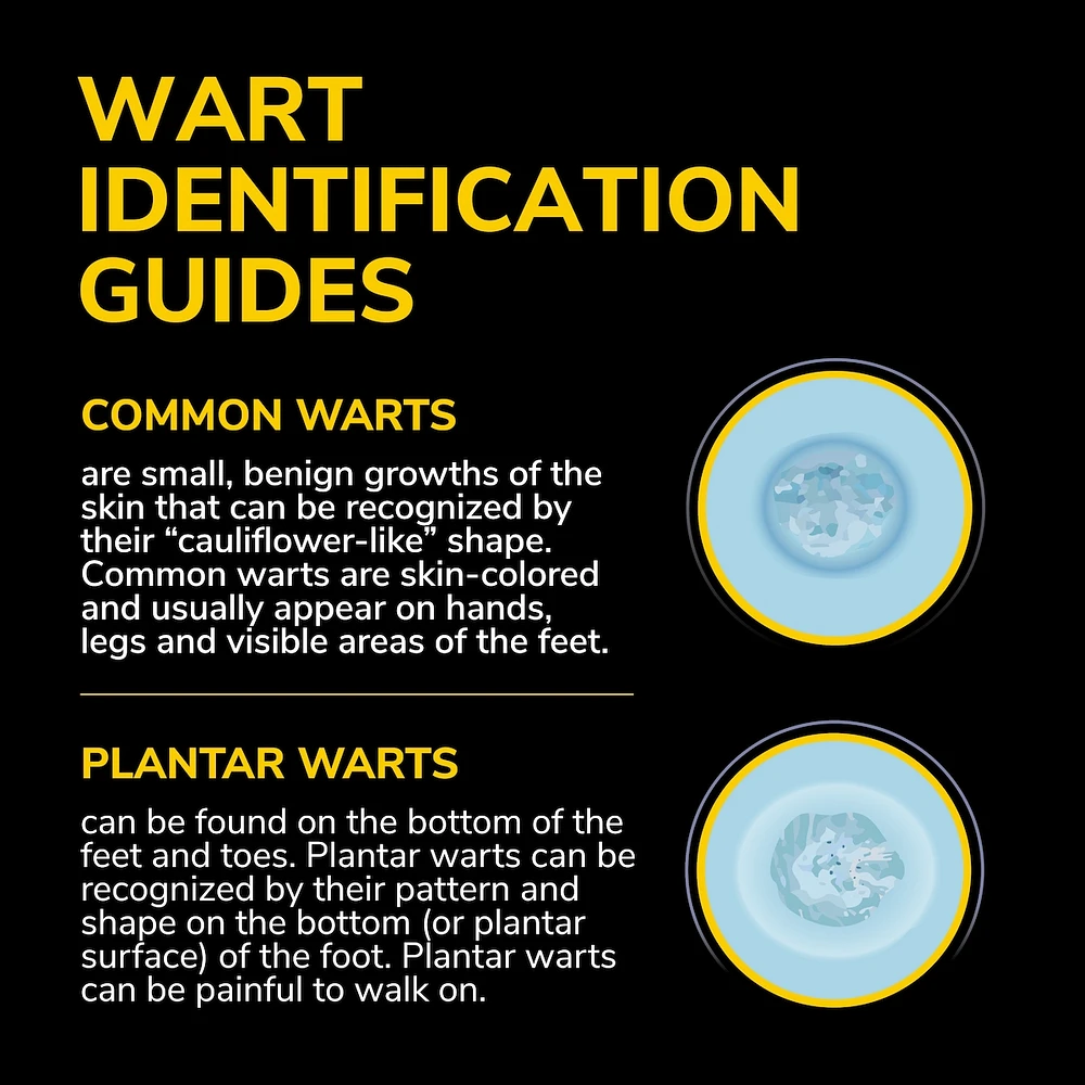 Plantar Wart Remover Gel