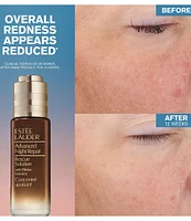 Estee Lauder Advanced Night Repair Rescue Solution Serum