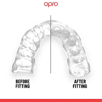 OPRO Adult Instant Custom-Fit Mouth Guard