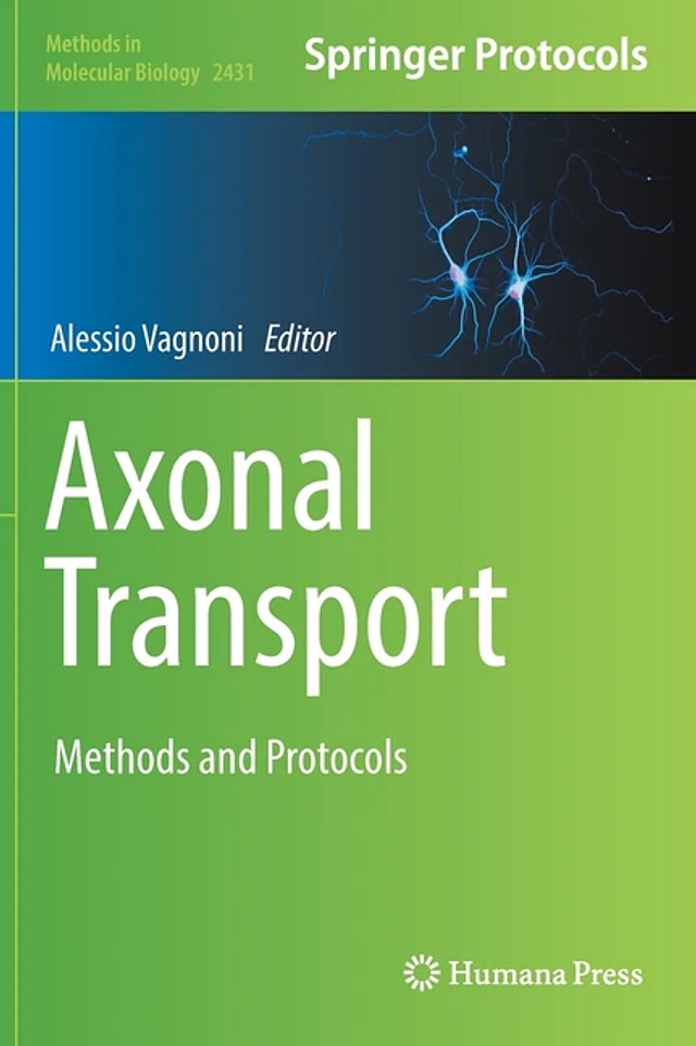 Axonal Transport by Alessio Vagnoni, Hardcover | Indigo Chapters