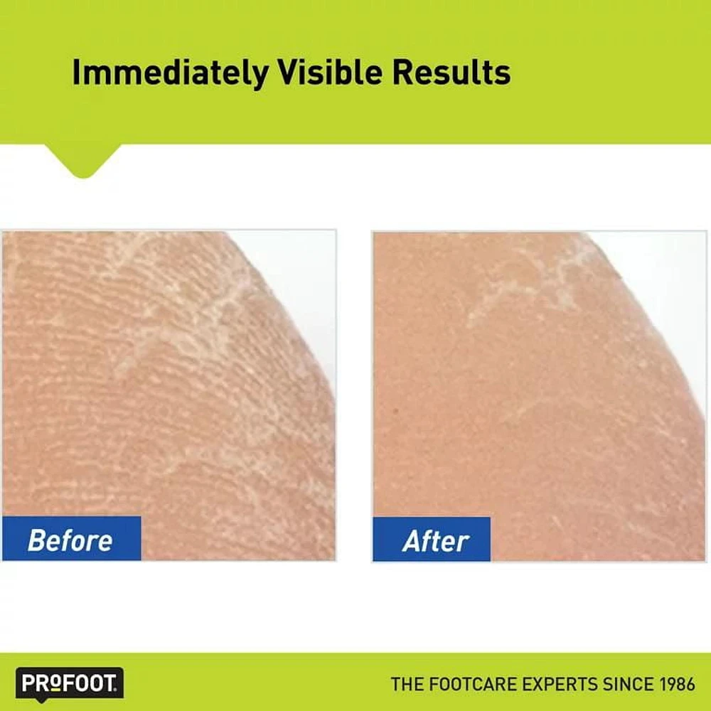 ProFoot® Heel Rescue Foot Cream, 454 g
