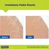 ProFoot® Heel Rescue Foot Cream, 454 g