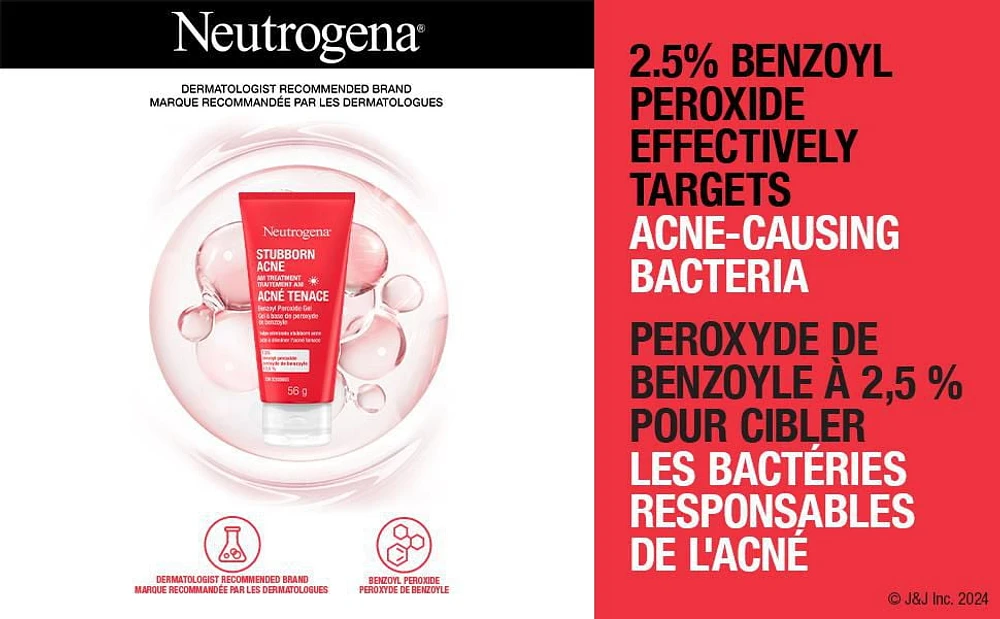 Neutrogena Stubborn AM Acne Treatment - Acne Breakout, Benzoyl Peroxide, Fragrance Free