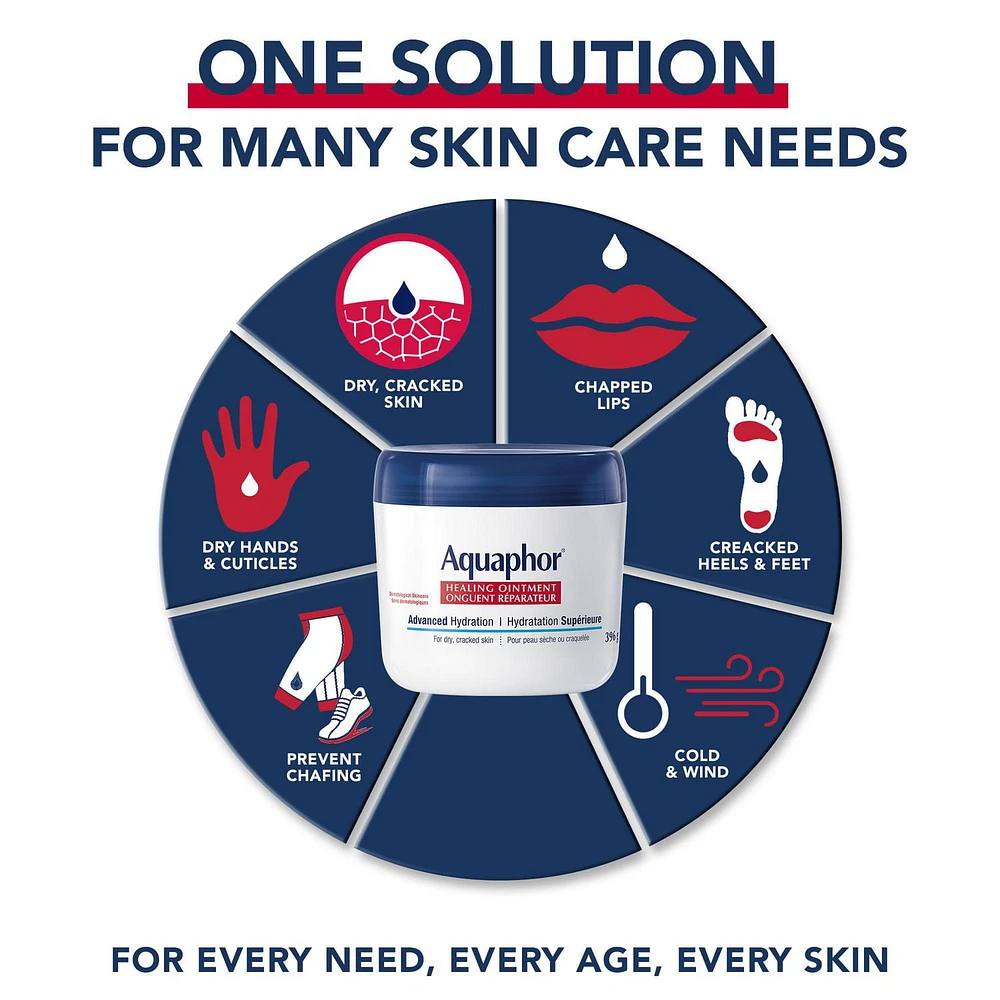 Onguent réparateur Aquaphor, multi-usage pour Peaux  sèches et craquelée 396g