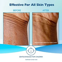 Glaxal Base Crème Hydratante 50 g - Pour le soulagement de la peau sensible 50 g Crème Hydratante