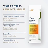 Dove Sérum Ciblé Dove Multifonction pour Vergetures, Taches Foncées, Teint Complexe Équilibrant de Teint, Niacinamide, Peptides de Collagène et Facteurs Naturels d'Hydratation, 95mL 95mL