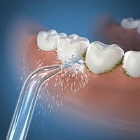 Waterpik® Classic Jet Tip