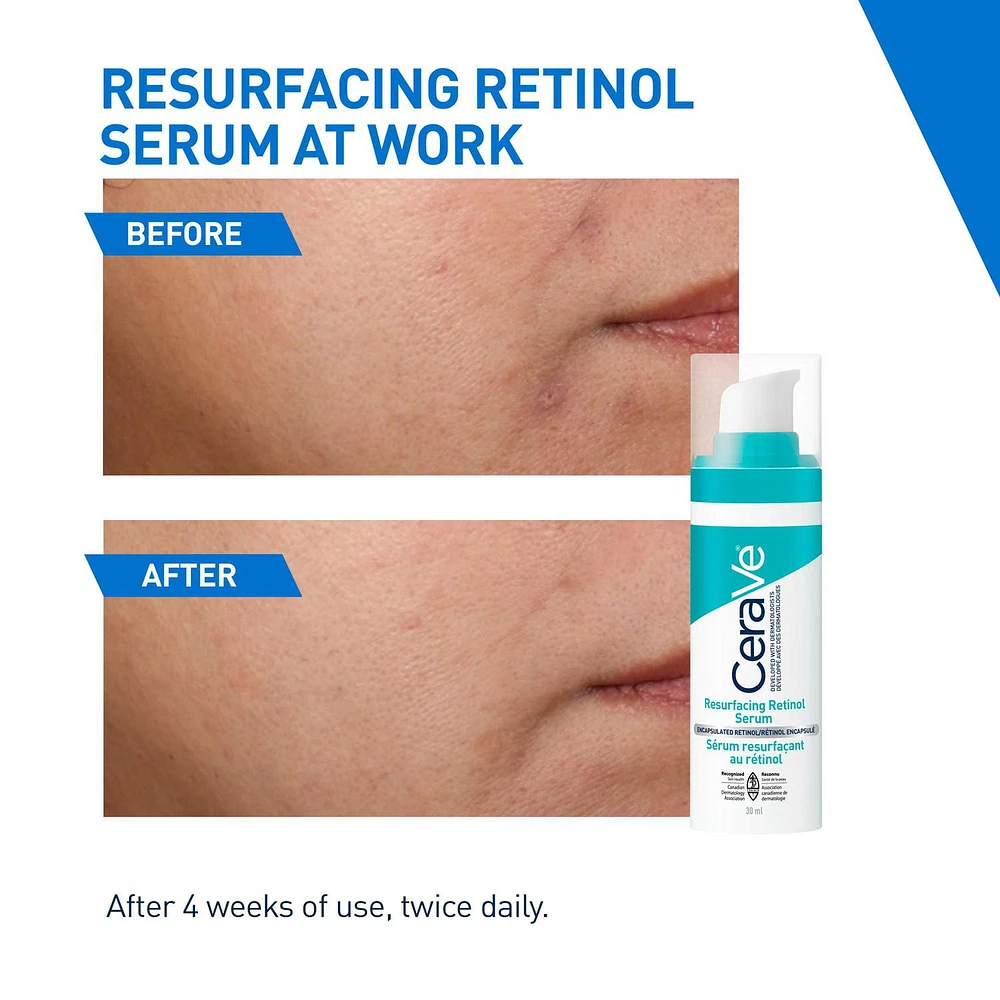 CeraVe Resurfacing Retinol Serum for Face with Niacinamide & Encapsulated Retinol. Helps even Skin Tone, Improve Skin Smoothness & Reduce Post-Acne Marks. Gentle, Fragrance-free, & Non-Comedogenic, 30ML, A full-face lightweight serum