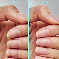 Sally Hansen - Repair + Rescue Insta-Smooth Ridge Filler, Formulé avec de l'acide hyaluronique, apprêt auto-nivelant, base pour vernis à ongles Comble les stries