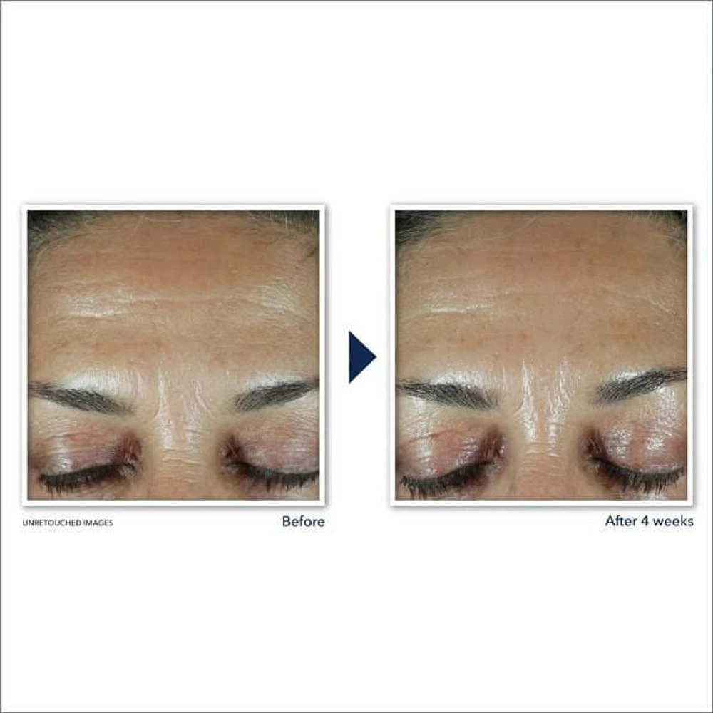 RoC Skincare - Retinol Correxion®️ - Rides profondes - Hydratant quotidien - Écran solaire à large spectre SPF 30 - 30ml RoC Skincare