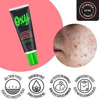 Oxy Deep Pore Acne Vanishing Treatment - 5% Benzoyl Peroxide – Stubborn Acne Control - Helps Treat, and Prevent Breakouts – Allows Skin to Heal - Dermatologist Tested, Acne Spot Treatment, 28g
