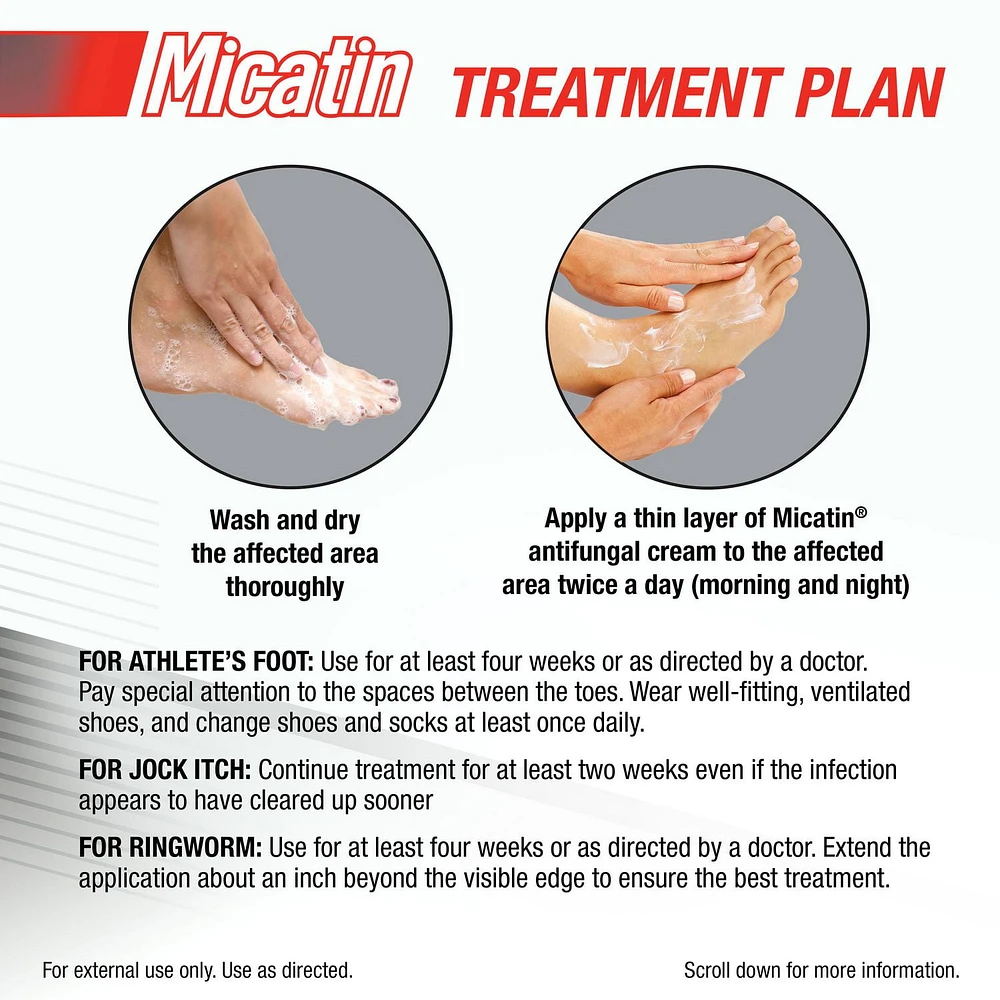 MicatinMD Crème à 2 % Miconzole nitrate USP pour le pied d'athlète, 30 g La guérison du pied d'athlète, des démangeaison