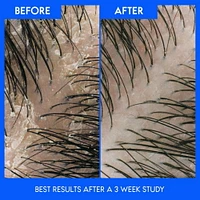 Head & Shoulders Avocado Oil 2 in 1 Anti-Dandruff Shampoo and Conditioner, 370ml