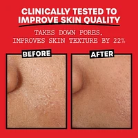 THAYERS Tonique Visage Non Parfumé Sans alcool formule à l'hamamélis et à l'aloès 355ml Tonique Visage Sans Alcool