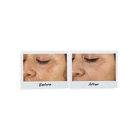 Clearly Corrective Dark Spot Solution Duo