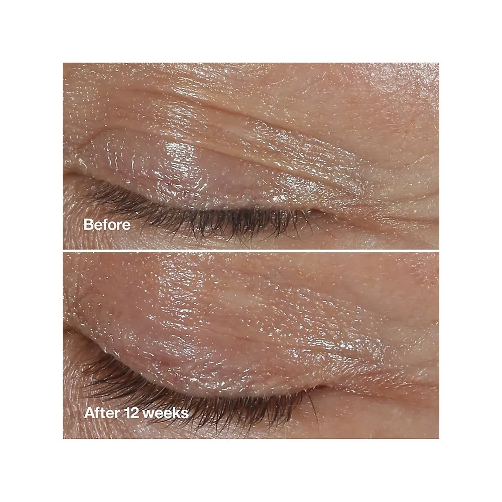 Smart Clinical Repair Wrinkle Correcting Eye Cream