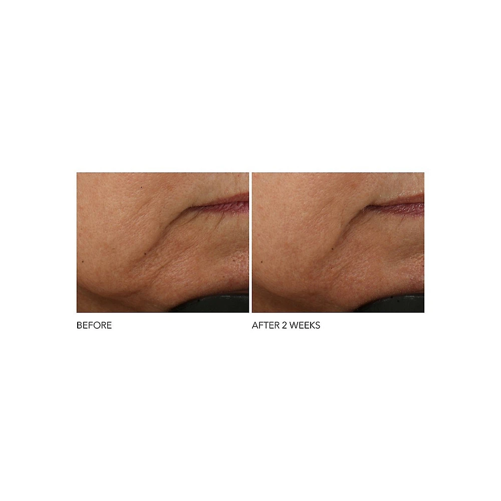 Crème anti-rides intense Advanced Retinol et Ferulic