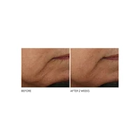 Crème anti-rides intense Advanced Retinol et Ferulic